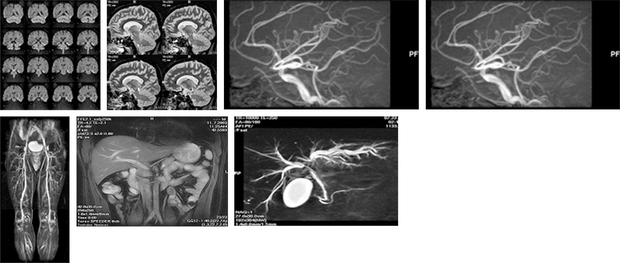 MRI